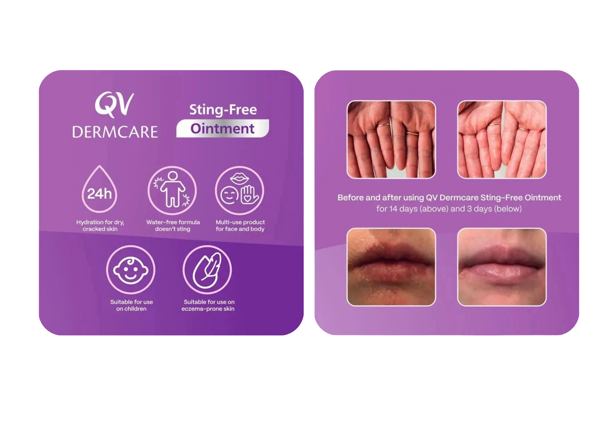 QV Dermcare Image.png