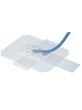 OPSITE POST-OP VIS DRAIN 10cmx9cm 20's