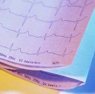 ECG Paper 108mm x 25m Roll ELI 100