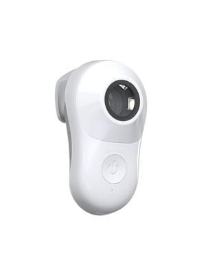 MoleScope II Dermatoscope Iphone 7+ Technology Skin Surface