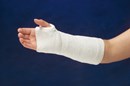 Specialist® Plaster of Paris 15cm - Box/12